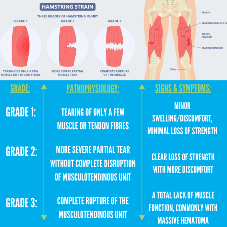 Section 4 – Grades of Hamstring Injuries | Physio Performance